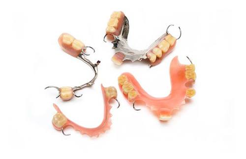 Four types of partial dentures