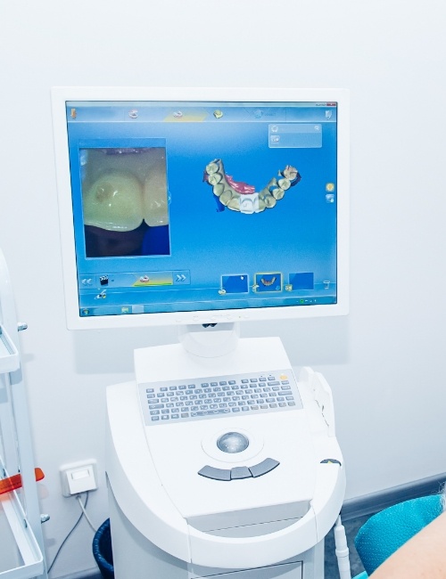 Digital dental impressions on chairside computer screen