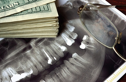 Dental x-ray with a pile of money on it